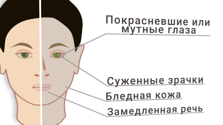 Признаки наркомана. Признаки наркомана.
